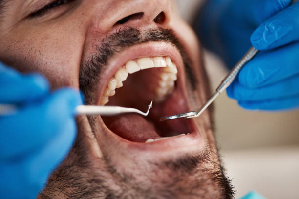Best Emergency Treatment for Dental Infections or Abscesses in Taft Heights, CA